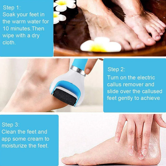 0229 Electronic Foot File Callous Remover - Battery-Powered Hard Skin Remover for Smooth Feet at Home - Zidbik
