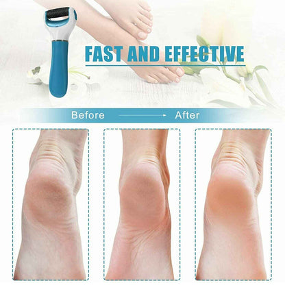 0229 Electronic Dry Foot File Callous Remover For Feet Electric Foot With Roller Hard And Dead Skin- Regular Coarse Baby Smooth Feet In Minutes. For In Home Padicure Foot Care Battery Powered  Usb (Battry Not Included) - Zidbik
