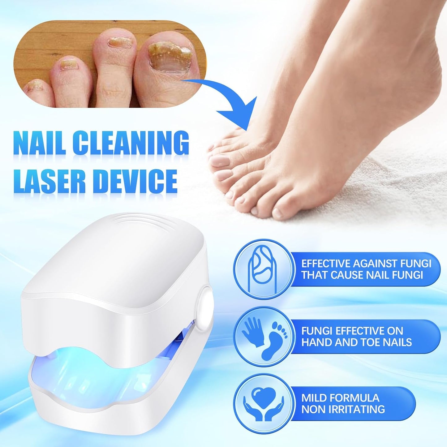 12915 Rechargeable Nail Fungus Treatment For Toenail Toe Nail Fungal Treatment Nail Fungus Laser Device Anti-fungal Nail Treatment For Hand  Feet Infections Remover For Home Use - Zidbik