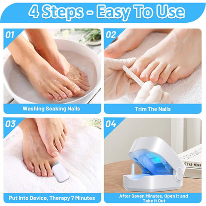 12915 Rechargeable Nail Fungus Treatment For Toenail Toe Nail Fungal Treatment Nail Fungus Laser Device Anti-fungal Nail Treatment For Hand  Feet Infections Remover For Home Use - Zidbik