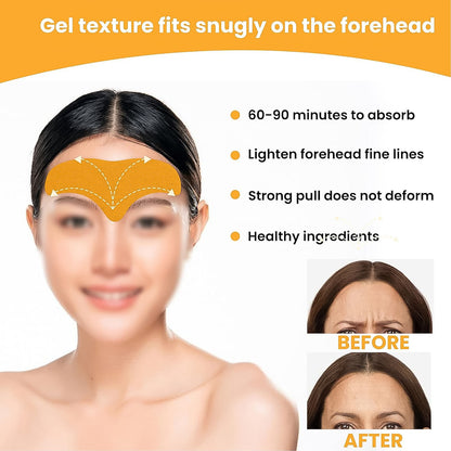 Forehead Wrinkle Patches Face Wrinkle Patches (10 Pcs Set) - Zidbik