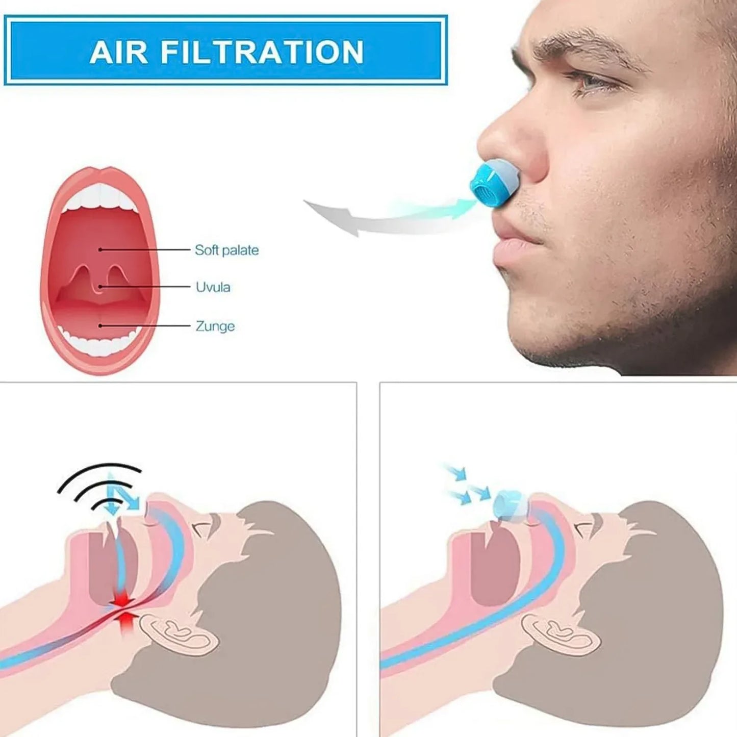 2 In 1 Anti Snoring And Air Purifier Nose Clip Anti Snoring Device (1 Pc With Plastic Case) - Zidbik