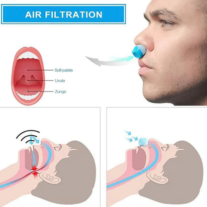 2 In 1 Anti Snoring And Air Purifier Nose Clip Anti Snoring Device (1 Pc With Plastic Case) - Zidbik