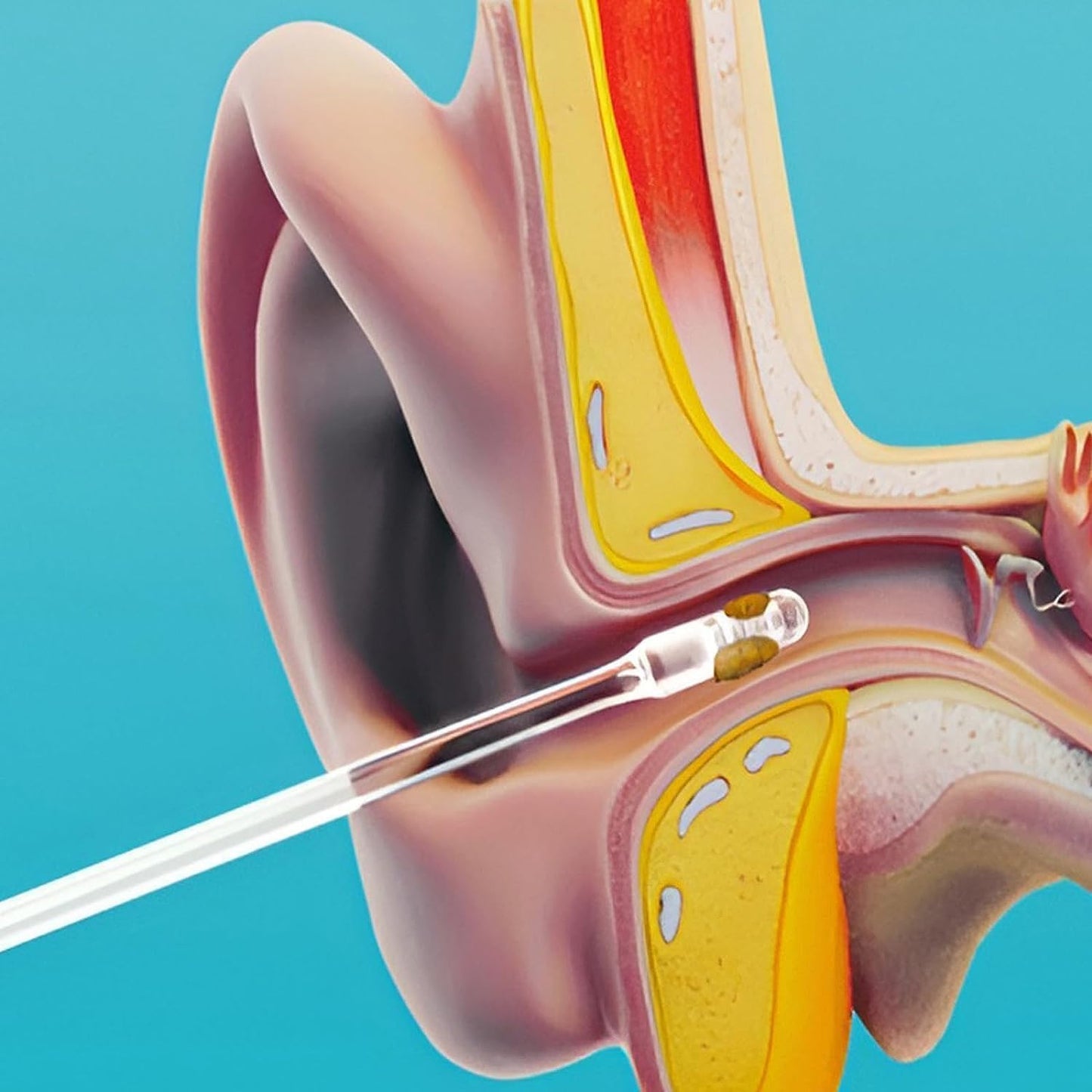 Ear Wax Cleaner Stick Silicone Reusable Sticky Ear Wax Removal Kit (12 Pcs Set) - Zidbik