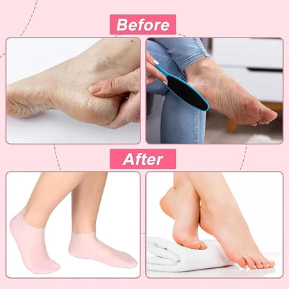 Silicone Moisturizing Socks (1 Pair) - Zidbik